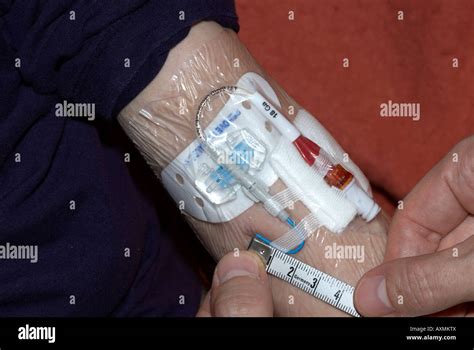 Measuring a Picc line after cleaning - peripherally inserted central catheter Stock Photo - Alamy