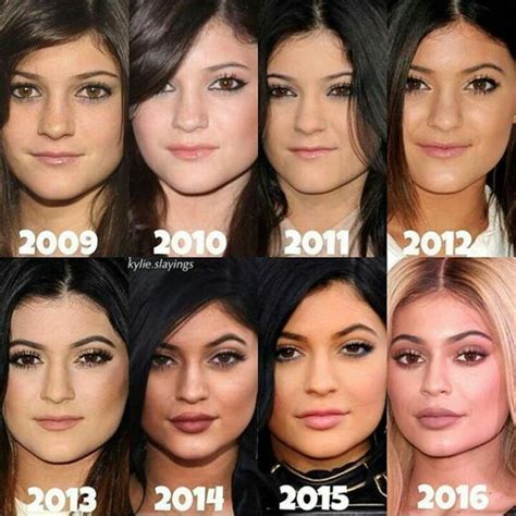 Kylie Jenner's Beauty Transformation Through the Years | Chirurgia ...