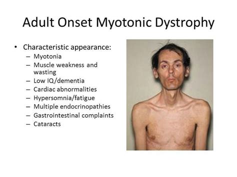 Myotonic Muscular Dystrophy - MEDizzy