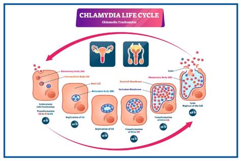 Chlamydia Infection : Symptoms, Causes, Risks & Diagnosis