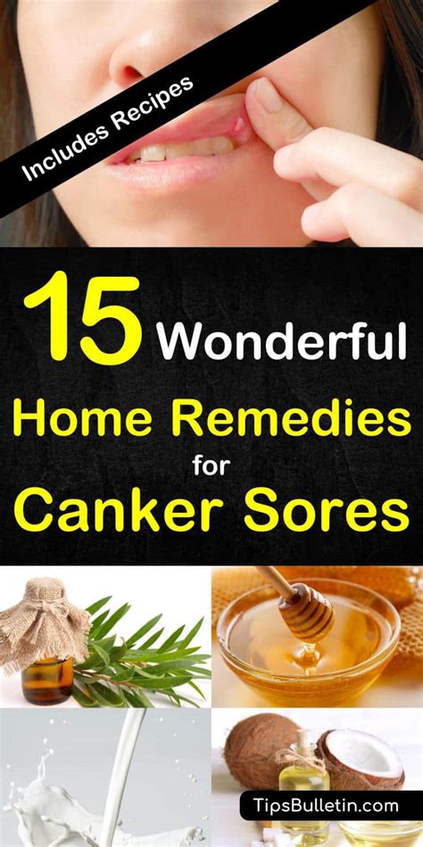 15 Canker Sore Relief Remedies That Work