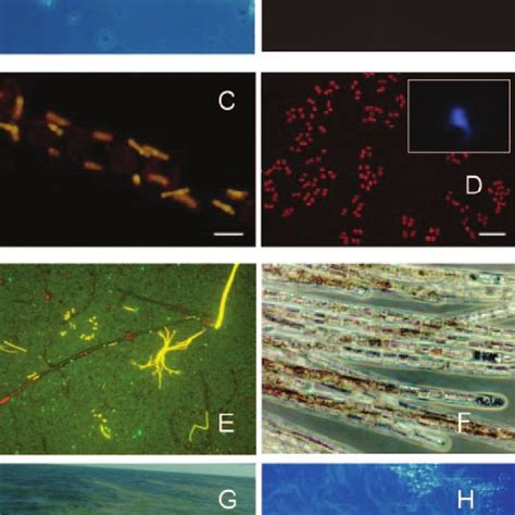 Examples of photoautotrophic marine diazotrophs. (A) Light microscope ...