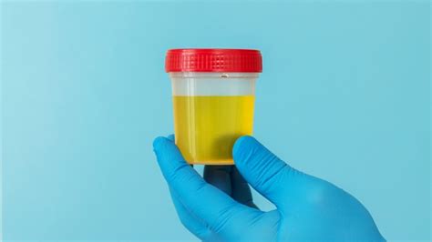 Foamy urine? Causes and remedies - youwillfit Blog