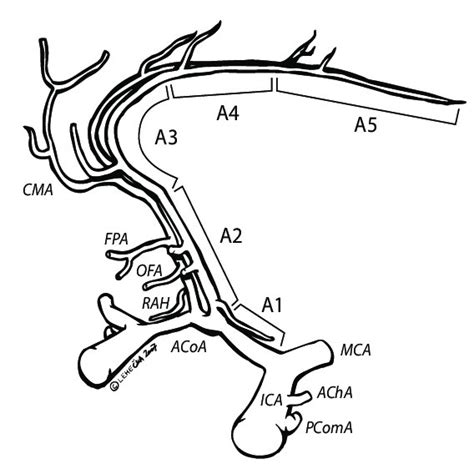 The segments (A1 to A5) and branches of the anterior cerebral artery ...