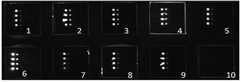 A Chemiluminescent Protein Microarray Method for Determining the Seroglycoid Fucosylation Index ...