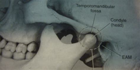 Eastwind Chiropractic Center | TMJ Dysfunction