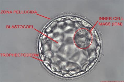 What is Embryo Grading in IVF? How embryologists Grade the Quality of an Embryo? Should we ...