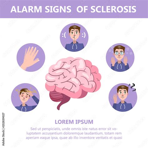 Sclerosis symptoms and signs. Brain damage disease Stock Vector | Adobe Stock