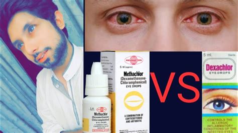 How to cure eye infection,review of methachlor, review of dexachlor eye drops, best eye drops ...