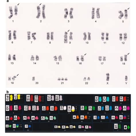 Cytogenetic characterization of the karyotype at the Day 180. a... | Download Scientific Diagram