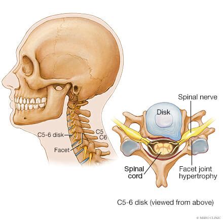 my chronic pain is way worse than surgery pain : r/ChronicPain