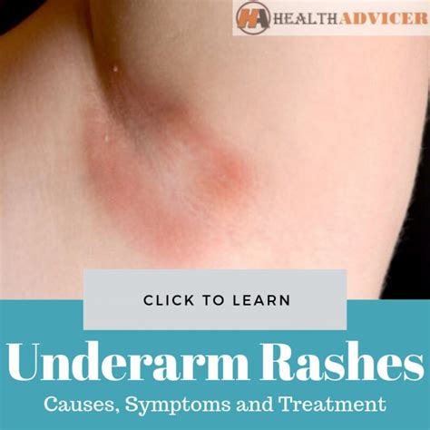 Underarm Rashes: Causes, Picture, Symptoms And Treatments