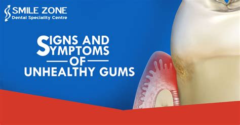 Signs And Symptoms of Unhealthy Gums