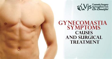 Gynecomastia - Symptoms, Causes And Surgical Treatment