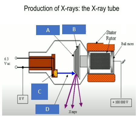 X-Ray Imaging Diagram | Quizlet