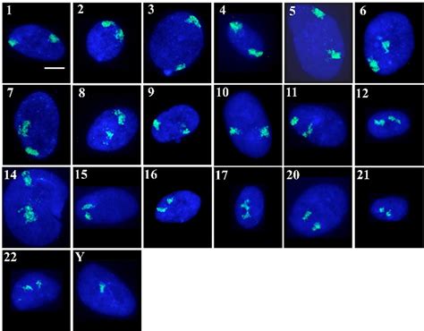 Frontiers | Interphase Chromosomes in Replicative Senescence ...