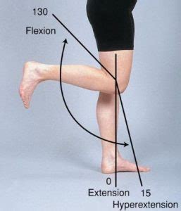 Hyperextended Knee - Symptoms, Recovery Time, Treatment