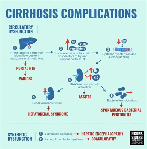 Managing Cirrhosis-Related Complications: Ascites, Hepatic Encephalopathy, And Variceal Bleeding ...