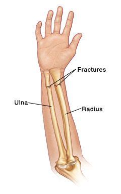 Radius and ulna, Human bones anatomy, Forearm bones