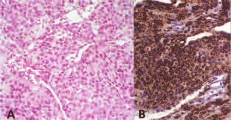 (A) Histology revealed glomus cells with typical centrally located ...