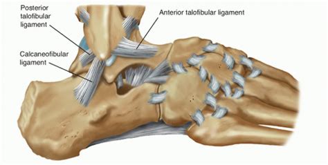 Chronic Lateral Ankle Instability | Musculoskeletal Key