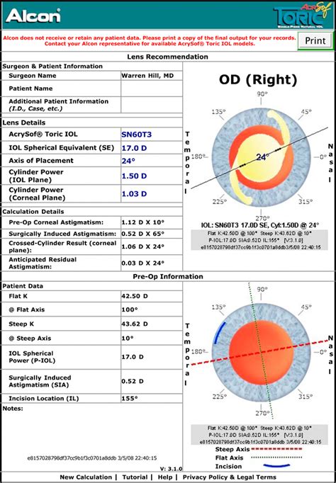 Alcon AcrySof Toric IOL Calculator | East Valley Ophthalmology