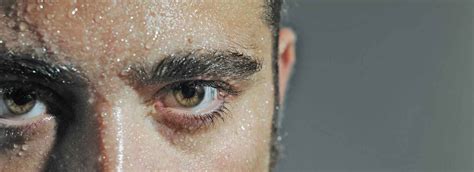 How to Deal with Excessive Sweating on Head - MiraDry Miami