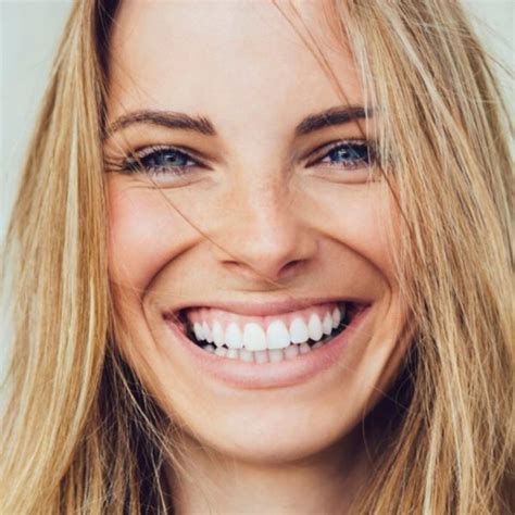 Common questions about Invisalign for straightening the smile