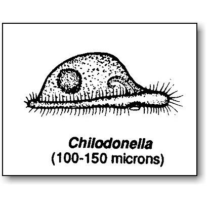 Ciliophora | Microbus Microscope Educational Website