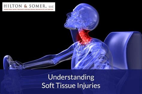 Understanding Soft Tissue Injuries - Hilton & Somer LLC