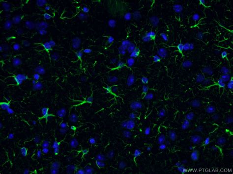 GFAP Antibody (16825-1-AP)