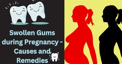 Swollen Gums during Pregnancy - Causes and Remedies