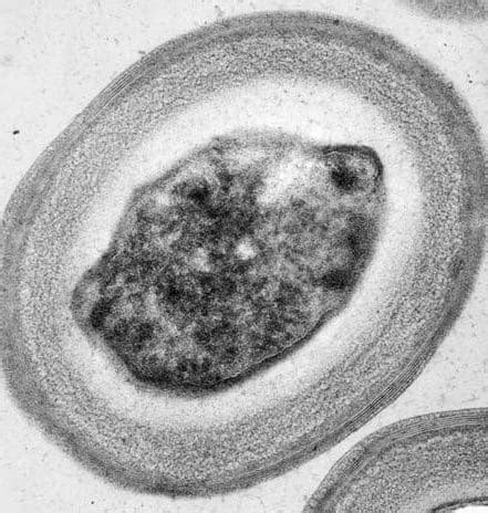 Geobacillus stearothermophilus | Microchem Laboratory