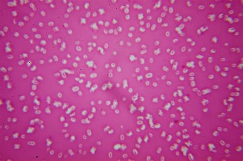 Free Stock Photo of Klebsiella pneumoniae capsule stain | Download Free Images and Free ...