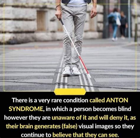 There is a very rare condition called ANTON SYNDROME, in which a person ...