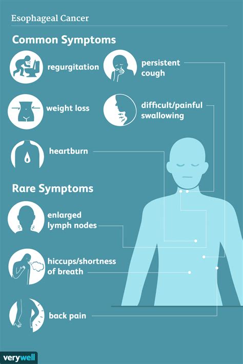 Esophageal Cancer: Signs and Symptoms