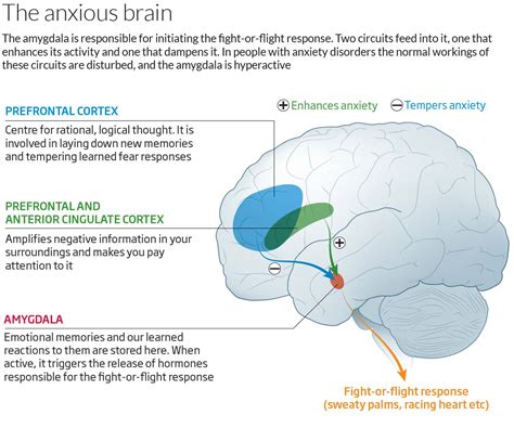 Anxiety – Dr. Sonia Maxwell