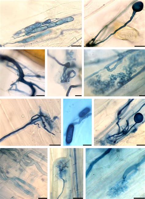 -Arbuscular mycorrhiza in roots of E. bogotense (a-e) and L ...