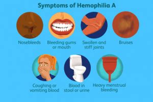 Hemophilia | MS Ramaiah Memorial Hospital