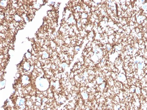 Myelin Basic Protein Antibody - Clone MBP/4271 - Gene ID 4155