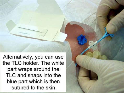 Clinical Notes: Central Line Placement: A Step-by-Step Procedure Guide with Photos