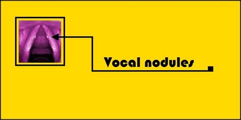 Vocal Nodules