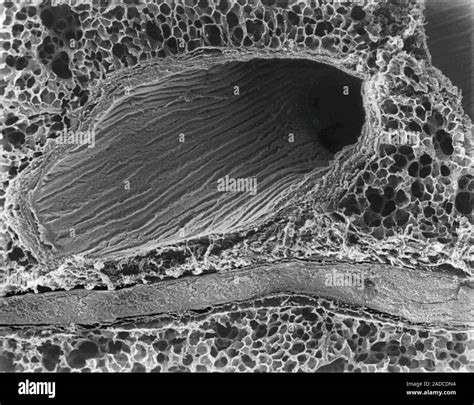 Lung - respiratory bronchiole, alveoli, and blood vessel, scanning electron micrograph (SEM ...