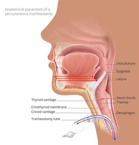 What Is Tracheostomy? Basics Of Breathing, Indications, Procedures And Benefits | Tracheostomy ...