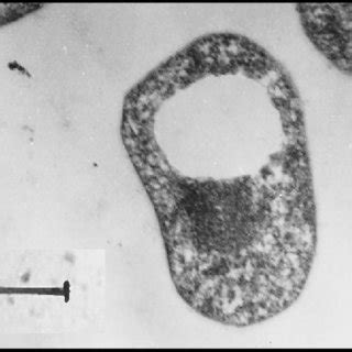 (PDF) CRISPR system in Picrophilus torridus.