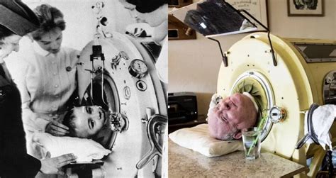 Meet Paul Alexander, The Man Who’s Lived In An Iron Lung For 70 Years ...