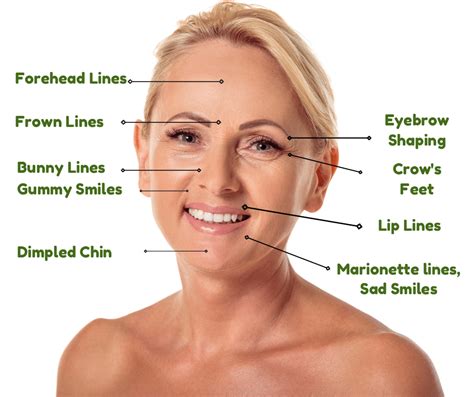 8 Types of Wrinkles Smoothed by BOTOX® Cosmetic & Dermal Fillers ...