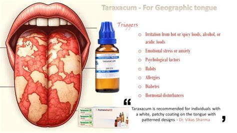 Effective Home Treatments for Geographic Tongue - Tips & Remedies