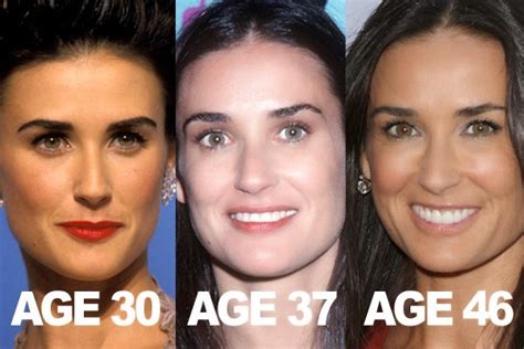 Demi Moore Plastic Surgery