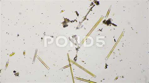 Freshwater Diatoms Identification